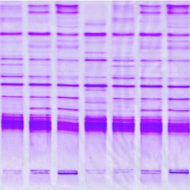 Total protein of Potato Varieties separated with Sinulyte carrier ampholyte pH 3-10